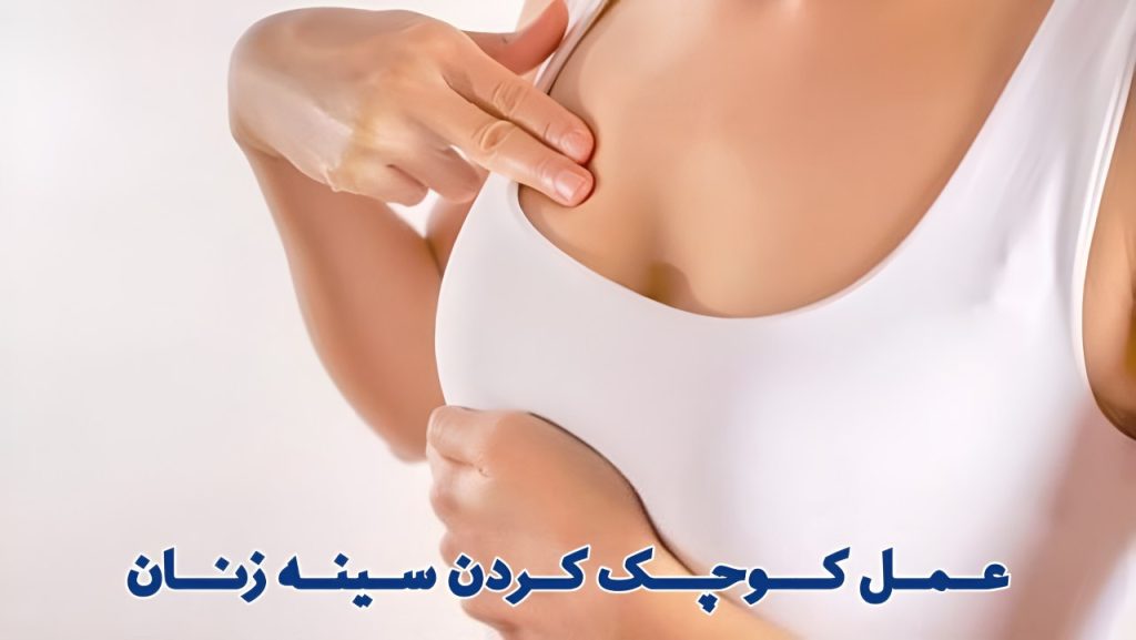 جراحی کوچک کردن سینه