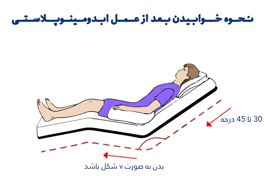 مراقبت های بعد از عمل ابدومینوپلاستی