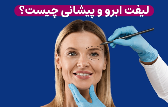 لیفت ابرو و پیشانی چیست؟