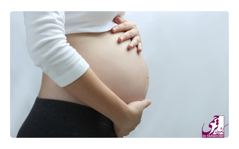 آیا بعد از عمل ابدومینوپلاستی میتوان باردار شد