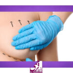 بهترین جراح لیفت سینه در تهران