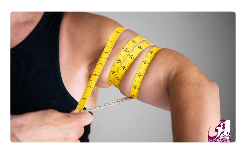 ماندگاری نتایج عمل لیفت بازو