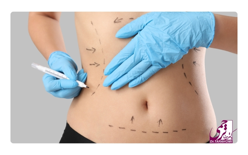 لیپوماتیک ساعت شنی چیست