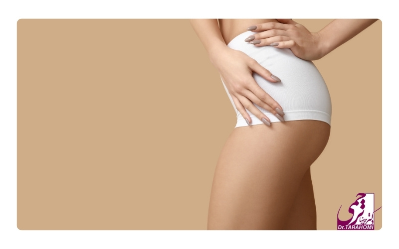 لیفت ران چیست