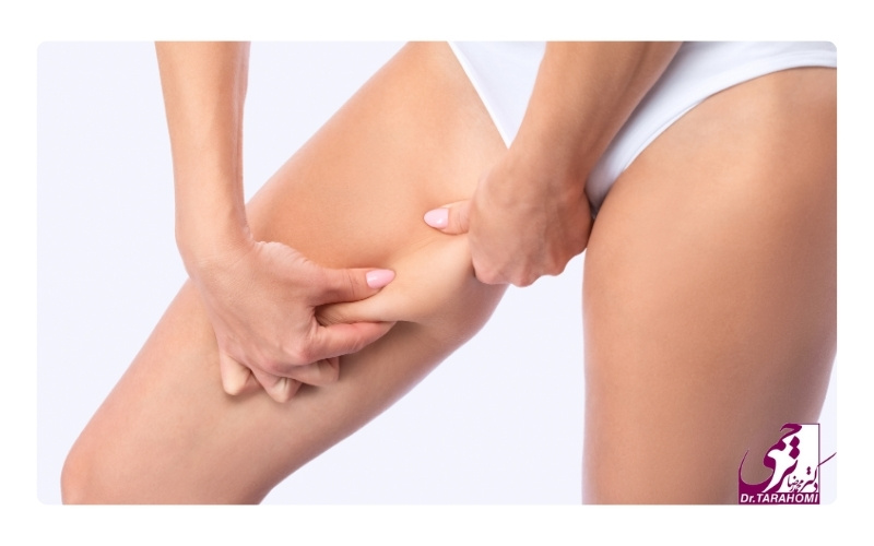 عمل لیفت ران