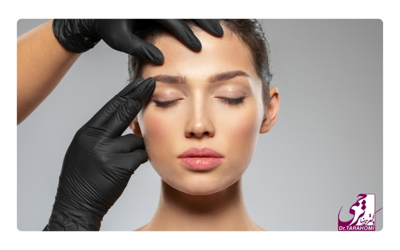 ماندگاری لیفت اندوسکوپیک ابرو چقدر است