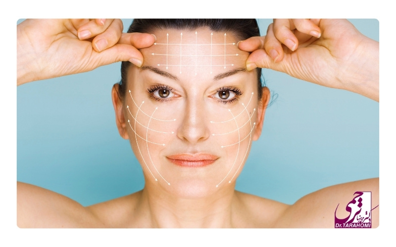 مقایسه ماندگاری لیفت اندوسکوپیک ابرو با دیگر متدهای جراحی