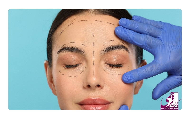 مراقبت های لازم برای ماندگاری لیفت اندوسکوپیک ابرو