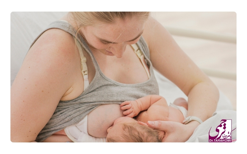 آیا باید ماموپلاستی بعد از شیردهی انجام شود؟