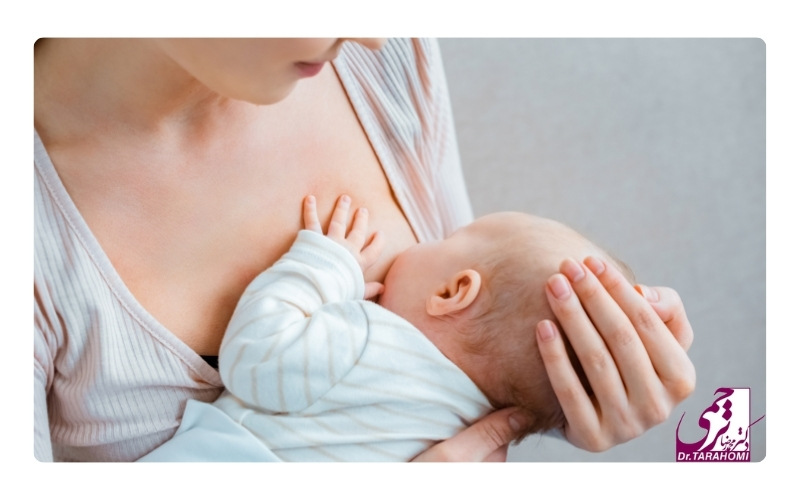 آیا ماموپلاستی باعث تخریب عروق شیردهی میشود؟