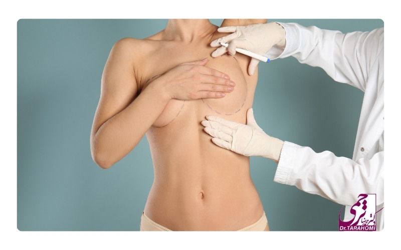 مراحل انجام عمل لیفت سینه
