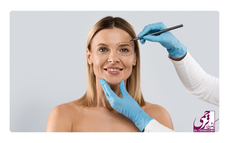 هزینه لیفت اندوسکوپی ابرو چقدر است