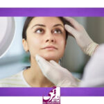 هزینه لیفت اندوسکوپی ابرو در سال 1404