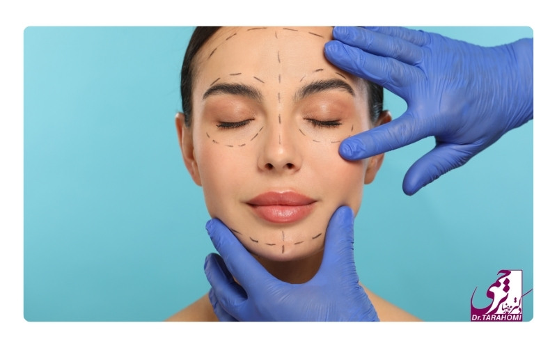 هزینه لیفت اندوسکوپی ابرو و شقیقه