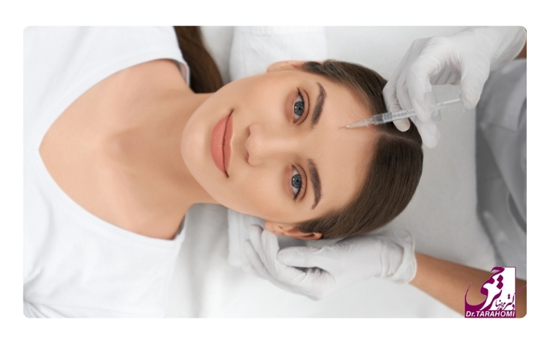 ماندگاری لیفت اندوسکوپیک پیشانی