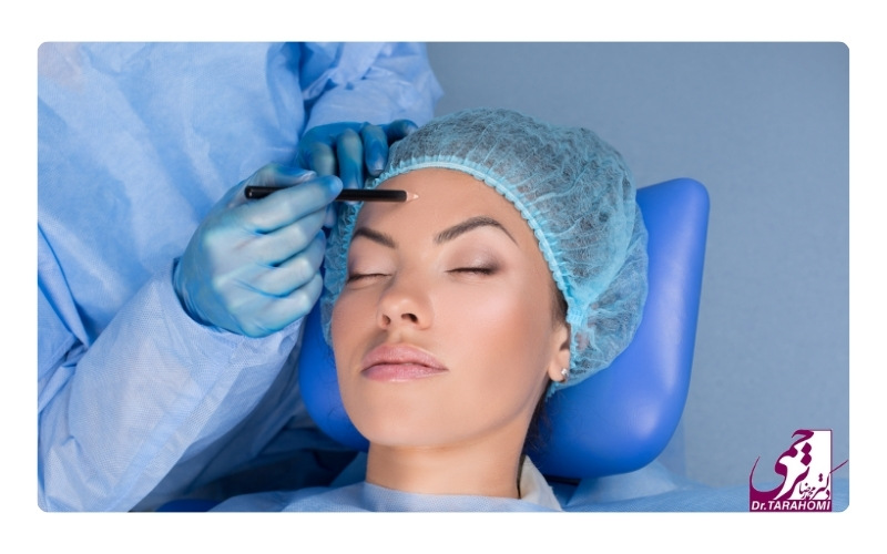 دوران نقاهت و مراقبت بعد از عمل لیفت اندوسکوپیک پیشانی