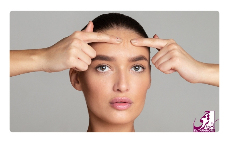 لیفت پیشانی با اندوتاین