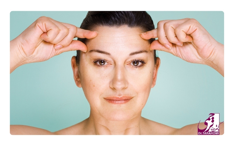 هزینه لیفت اندوسکوپیک پیشانی