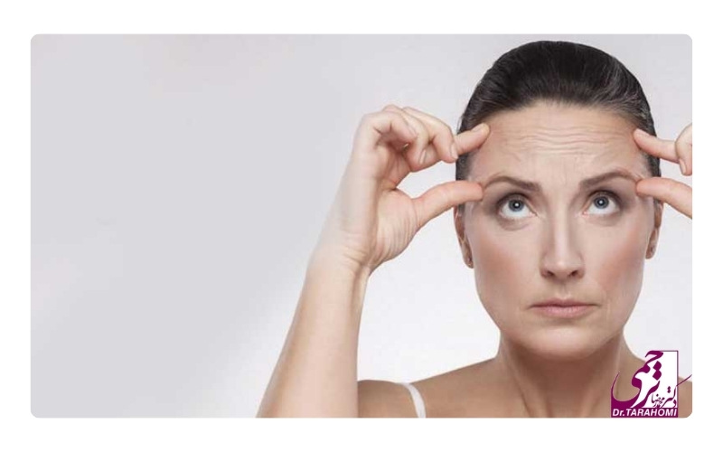 آیا لیفت اندوسکوپیک پیشانی برای شما مناسب است