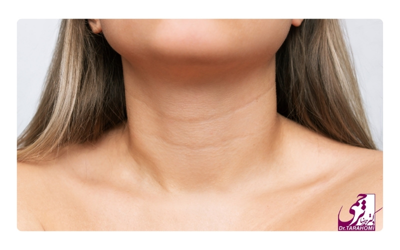 هزینه های جانبی لیفت گردن