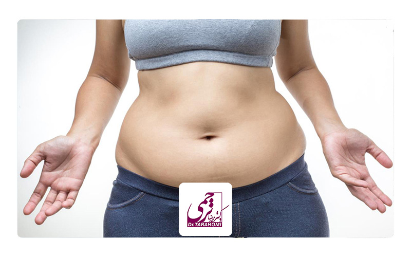میزان کاهش وزن با لیپوماتیک چقدر است