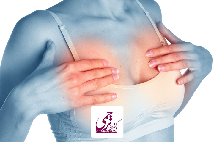 ورم سینه بعد از پروتز
