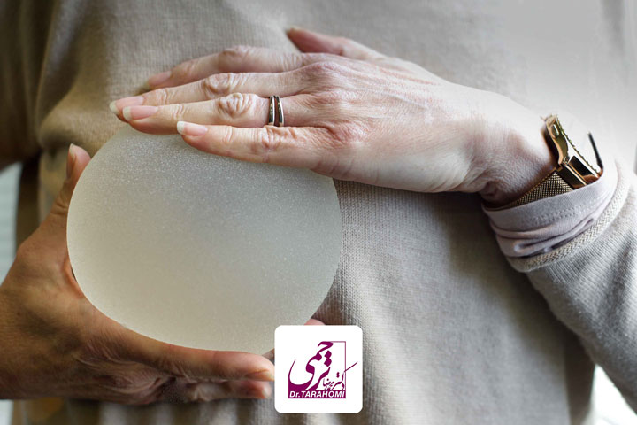 از دست دادن حس سینه بعد از پروتز