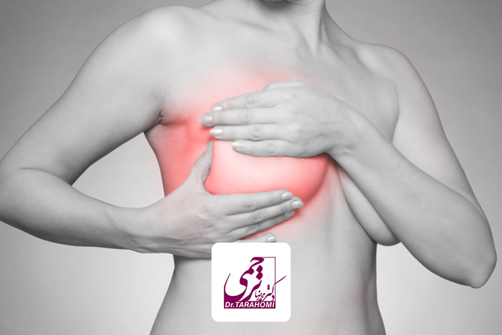 علت سوزش سینه بعد از پروتز چیست