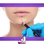 هزینه جراحی چانه چقدر است؟ بررسی قیمت و عوامل مؤثر