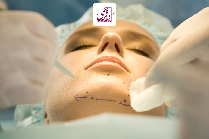 هزینه جراحی چانه